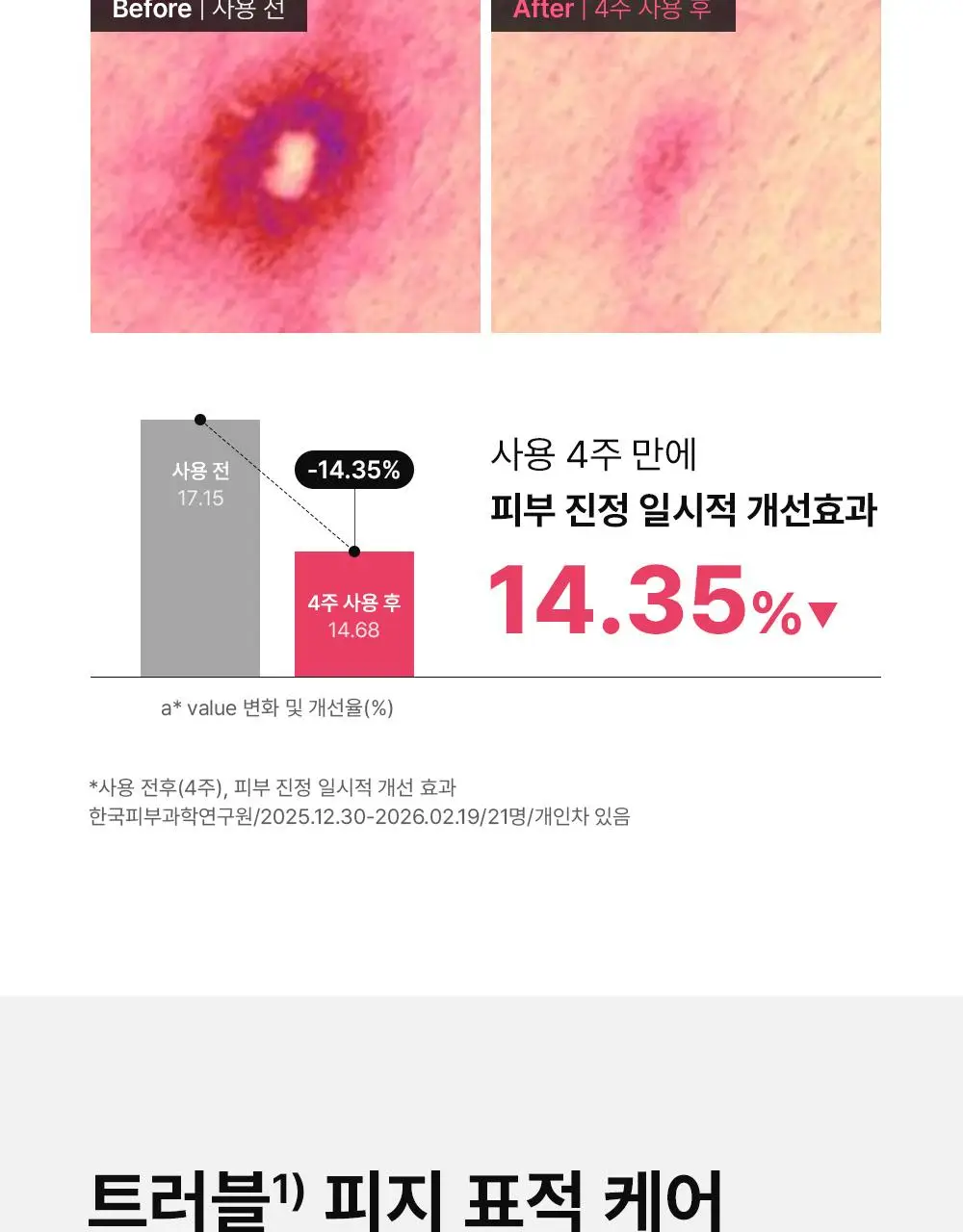 (하루특가)[단독기획] 동아제약 아크네 프로 크림제 30ml 기획(+3ml+겔제3ml) 상세페이지 12